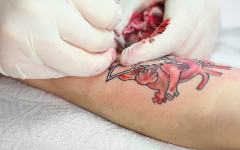 Заживление татуировки: как не допустить воспаления