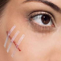 Пластырь для бесшовного сведения краев ран Стрипс 4х76 мм, №8. Набор из 2-х упаковок