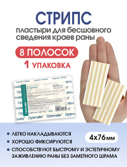 Пластырь для бесшовного сведения краев ран Стрипс 4х76 мм, №8